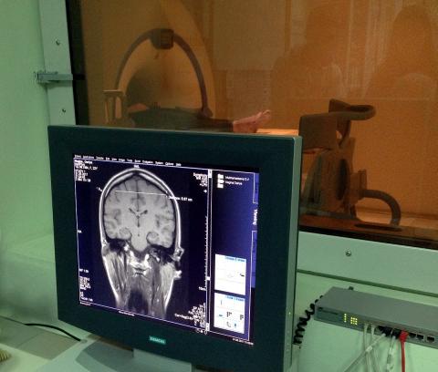 Ученые КФУ работают над улучшением качества МРТ-изображений с применением нанотехнологий