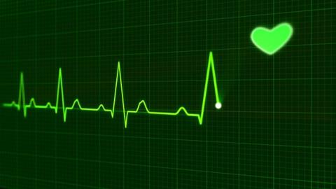 В униклинике КФУ пройдут мастер-классы по лечению больных с желудочковыми нарушениями ритма сердца