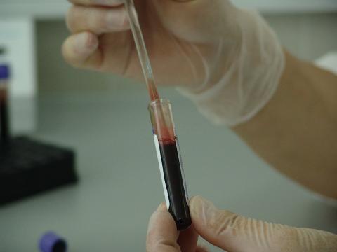 В униклинике КФУ пройдет бесплатное экспресс-тестирование на ВИЧ