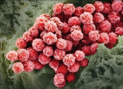 КФУ и Гиссенский университет (Германия) разрабатывают генно-клеточную терапию метастаз опухоли легких