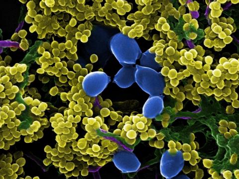 Ученые КФУ нашли «усилитель» антибиотиков