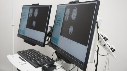 Ученые КФУ раскрыли новые аспекты механизмов мигрени